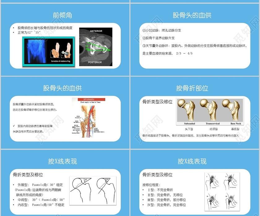 蓝色卡通股骨骨折的护理培训介绍PPT模板股骨颈骨折的护理PPT模板 蓝色卡通股骨骨折的护理培训介绍PPT模板股骨颈骨折的护理PPT模板